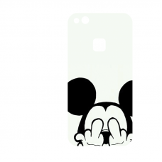 Силиконов гръб за Huawei P10 Lite - mickey